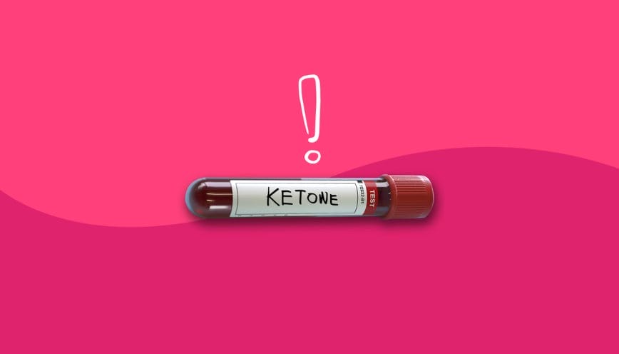 Vén màn thắc mắc “Ketone có phản ứng tráng bạc không?”